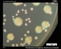 green p.aeruginosa, e.faecalis